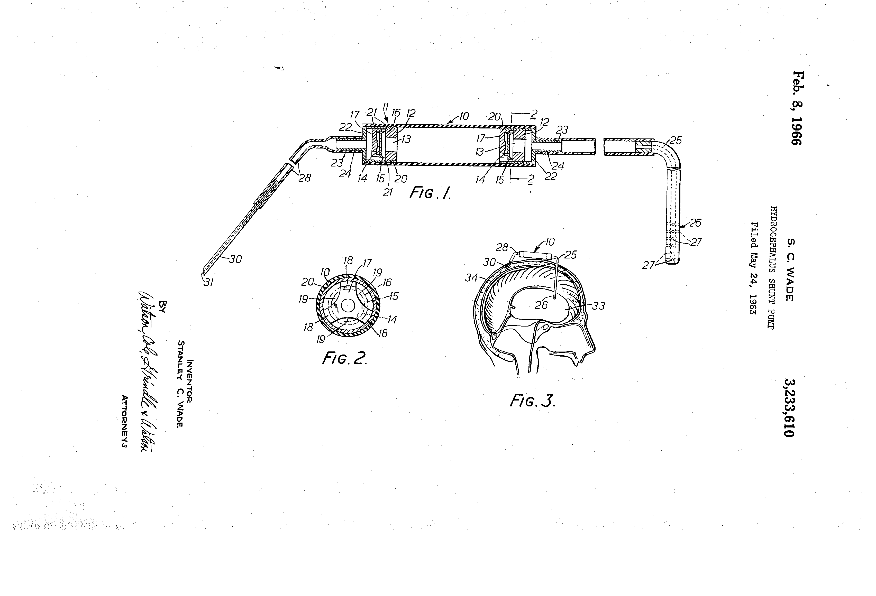 Prototype drawing of the Wade-Dahl-Till valve